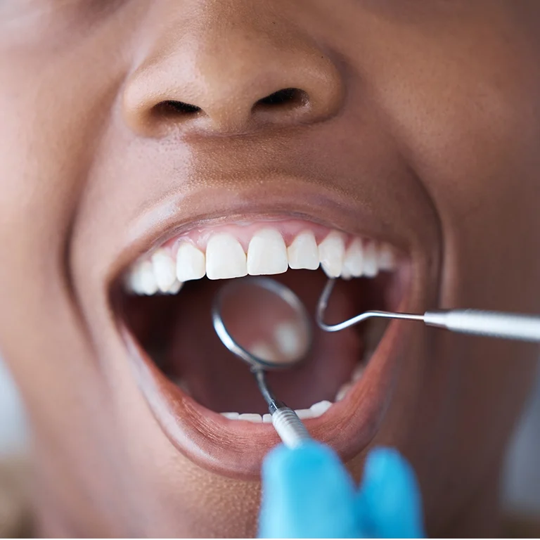 Checkup, teeth and woman with a dentist for oral hygiene, cavity check or cleaning mouth.